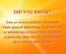 Sunburn warning